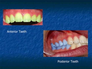 Anterior Teeth Posterior Teeth 