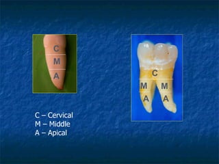 A M C A A M M C C – Cervical M – Middle A – Apical  