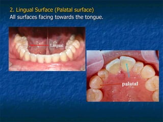 2. Lingual Surface (Palatal surface) All surfaces facing towards the tongue. palatal 