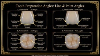 Tooth Case Classification Comprehensive Guide to Operative Dentistry: Nomenclature and ...