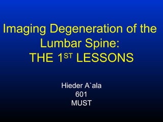 Imaging Degeneration of the
      Lumbar Spine:
    THE 1 LESSONS
          ST



          Hieder A`ala
              601
             MUST
 