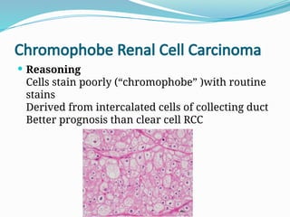 Nomenclature of Renal Cell Carcinoma and its Reasoning | PPTX