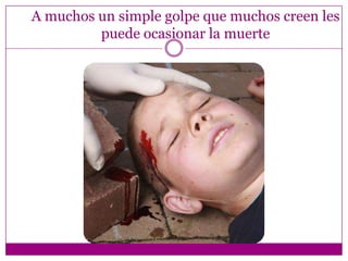 A muchos un simple golpe que muchos creen les
         puede ocasionar la muerte
 