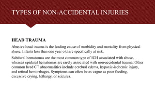Non Contact Injuries Examples NON-ACCIDENTAL INJURIES IN CHILDREN.pptx