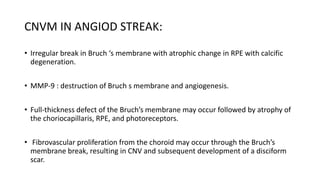 CNVM IN ANGIOD STREAK:
• Irregular break in Bruch ‘s membrane with atrophic change in RPE with calcific
degeneration.
• MMP-9 : destruction of Bruch s membrane and angiogenesis.
• Full-thickness defect of the Bruch’s membrane may occur followed by atrophy of
the choriocapillaris, RPE, and photoreceptors.
• Fibrovascular proliferation from the choroid may occur through the Bruch’s
membrane break, resulting in CNV and subsequent development of a disciform
scar.
 