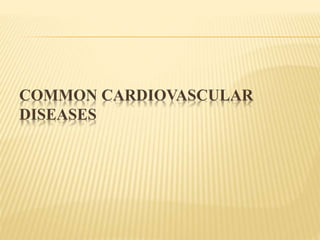 COMMON CARDIOVASCULAR 
DISEASES 
 