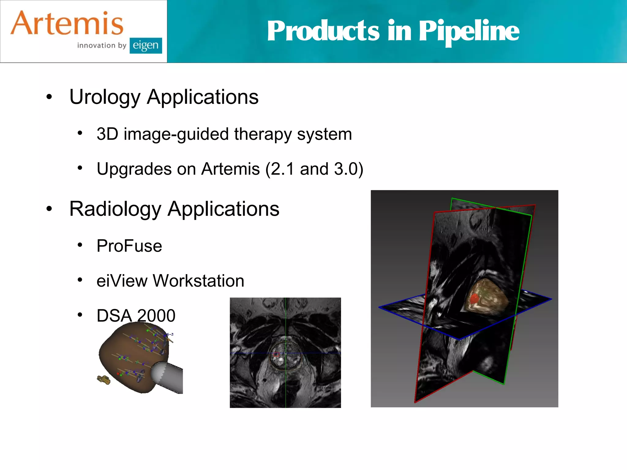 Products in Pipeline

• Urology Applications
   • 3D image-guided therapy system

   • Upgrades on Artemis (2.1 and 3.0)

• Radiology Applications
   • ProFuse

   • eiView Workstation

   • DSA 2000
 