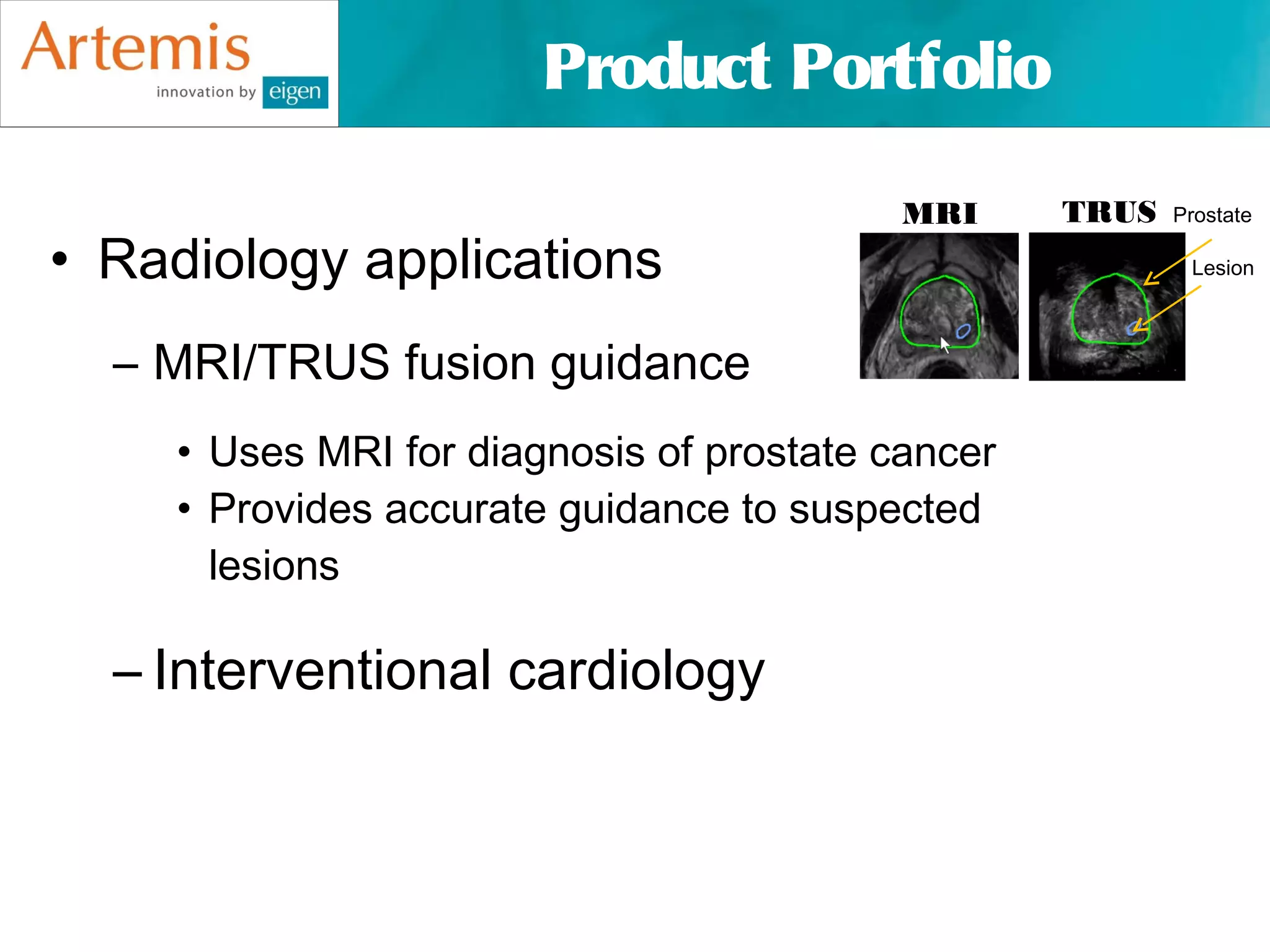Product Portfolio

                                          MRI     TRUS   Prostate

• Radiology applications                                  Lesion



  – MRI/TRUS fusion guidance
    • Uses MRI for diagnosis of prostate cancer
    • Provides accurate guidance to suspected
      lesions

  – Interventional cardiology
 