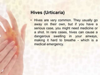 Hives (Urticaria) 
• Hives are very common. They usually go 
away on their own, but if you have a 
serious case, you might need medicine or 
a shot. In rare cases, hives can cause a 
dangerous swelling in your airways, 
making it hard to breathe - which is a 
medical emergency. 
 