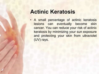 Actinic Keratosis 
• A small percentage of actinic keratosis 
lesions can eventually become skin 
cancer. You can reduce your risk of actinic 
keratosis by minimizing your sun exposure 
and protecting your skin from ultraviolet 
(UV) rays. 
 