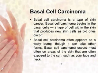 Basal Cell Carcinoma 
• Basal cell carcinoma is a type of skin 
cancer. Basal cell carcinoma begins in the 
basal cells — a type of cell within the skin 
that produces new skin cells as old ones 
die off. 
• Basal cell carcinoma often appears as a 
waxy bump, though it can take other 
forms. Basal cell carcinoma occurs most 
often on areas of the skin that are often 
exposed to the sun, such as your face and 
neck. 
• 
 