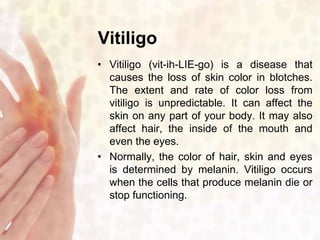 Vitiligo 
• Vitiligo (vit-ih-LIE-go) is a disease that 
causes the loss of skin color in blotches. 
The extent and rate of color loss from 
vitiligo is unpredictable. It can affect the 
skin on any part of your body. It may also 
affect hair, the inside of the mouth and 
even the eyes. 
• Normally, the color of hair, skin and eyes 
is determined by melanin. Vitiligo occurs 
when the cells that produce melanin die or 
stop functioning. 
 