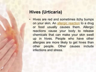 Hives (Urticaria) 
• Hives are red and sometimes itchy bumps 
on your skin. An allergic reaction to a drug 
or food usually causes them. Allergic 
reactions cause your body to release 
chemicals that can make your skin swell 
up in hives. People who have other 
allergies are more likely to get hives than 
other people. Other causes include 
infections and stress. 
 