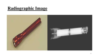 Radiographic Image
26
 