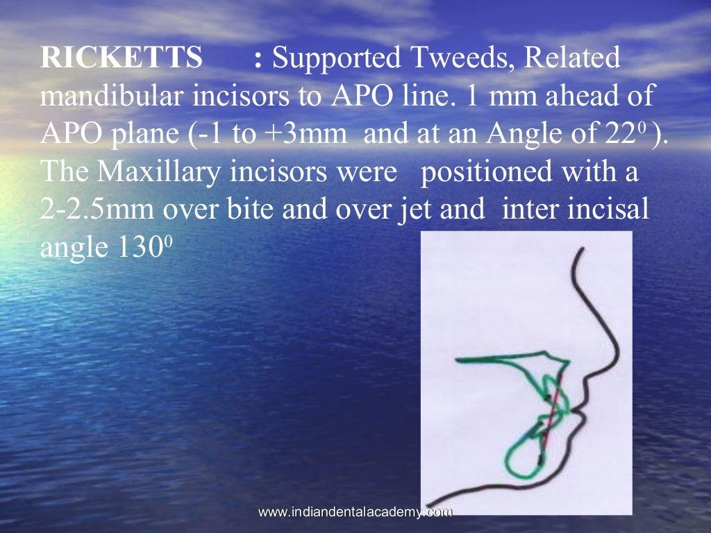 Non extraction treatment modality /certified fixed orthodontic course…