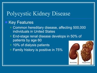 Polycystic Kidney Disease Key Features Common hereditary disease, affecting 500,000 individuals in United States End-stage renal disease develops in 50% of patients by age 60 10% of dialysis patients Family history is positive in 75% 