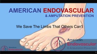 1
AMERICAN ENDOVASCULAR
& AMPUTATION PREVENTION
We Save The Limbs That Others Can't
 