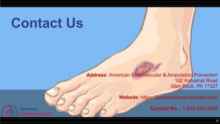 6
Contact Us
Address: American Endovascular & Amputation Prevention
182 Industrial Road
Glen Rock, PA 17327
Website: https://americanendovascular.com/
Contact No. : 1-833-426-3636
 