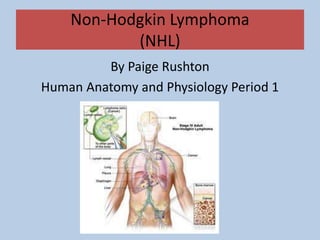 Non-Hodgkin Lymphoma
(NHL)
By Paige Rushton
Human Anatomy and Physiology Period 1
 