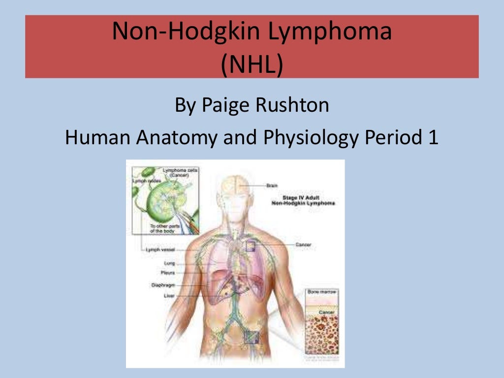 Non hodgkin lymphoma