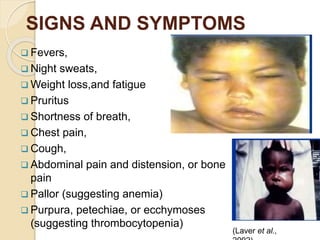 Non-Hodgkin lymphomas.pptx