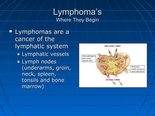Non hodgkins lymphoma