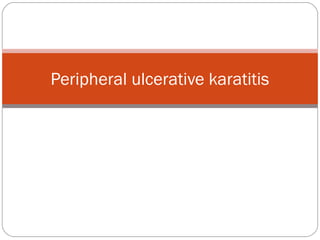 Peripheral ulcerative karatitis
 