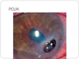 PCUK
 