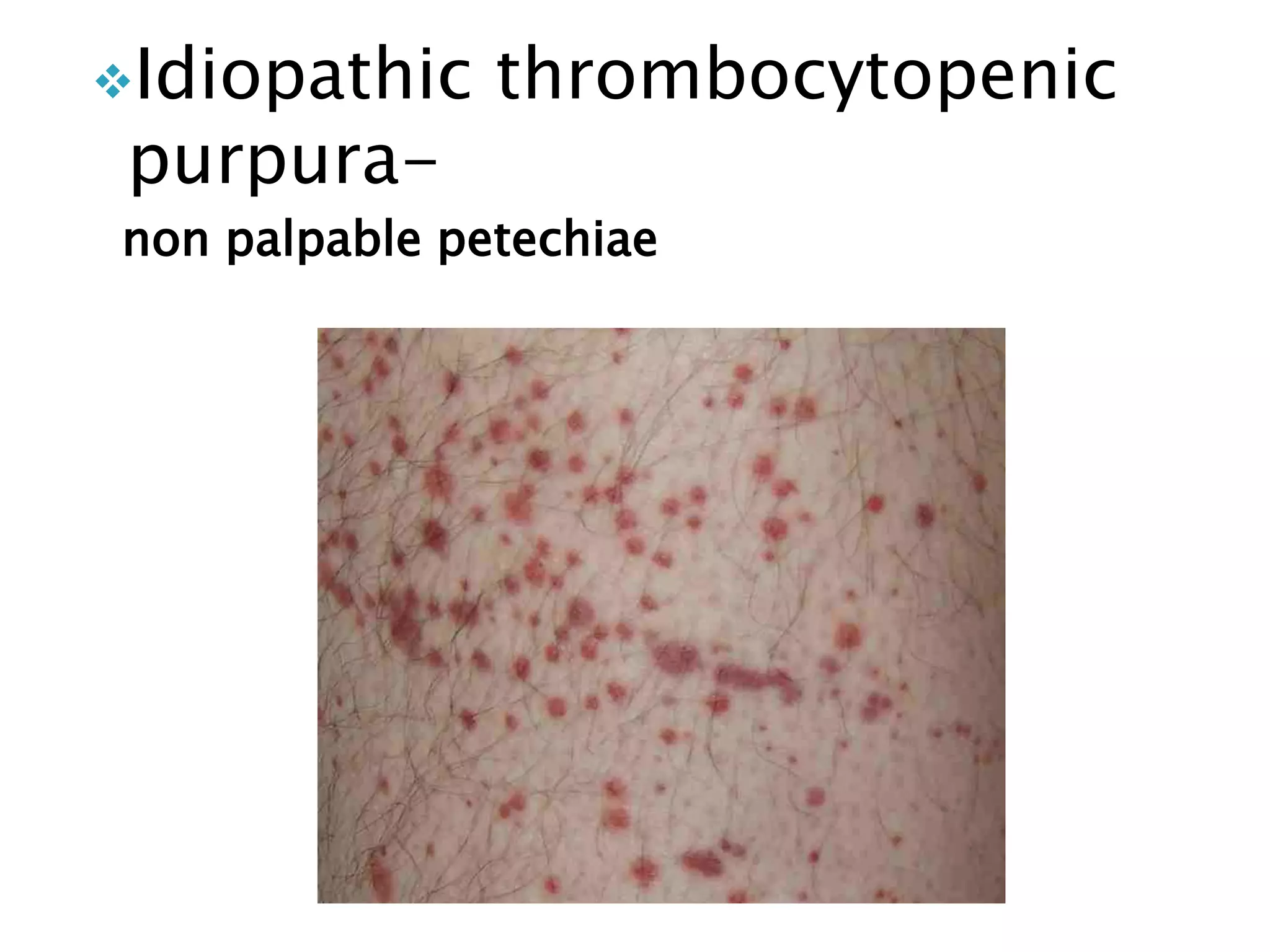 non-infectious-cutaneous-manifestations-of-hiv-pptx