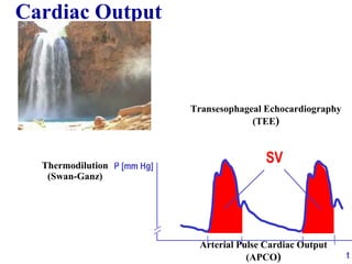 Arterial Pulse Cardiac Output
(APCO)
Transesophageal Echocardiography
(TEE)
Thermodilution
(Swan-Ganz)
Cardiac Output
 