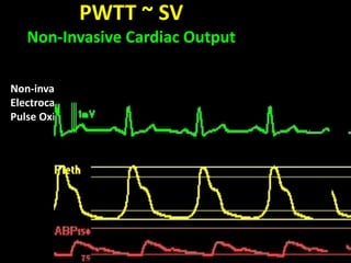 Non-invasive Blood Pressure (NIBP)
Electrocardiography (ECG)
Pulse Oximetry (SpO2)
PWTT ~ SV
Non-Invasive Cardiac Output
 