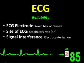• ECG Electrode: Avoid hair or reused
• Site of ECG: Respiratory rate (RR)
• Signal Interferance: Electrocauterization
ECG
Reliability
 