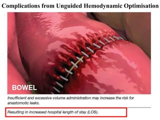 Complications from Unguided Hemodynamic Optimisation
 