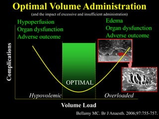 Bellamy MC. Br J Anaesth. 2006;97:755-757.
Complications
Volume Load
OPTIMAL
Edema
Organ dysfunction
Adverse outcome
Hypoperfusion
Organ dysfunction
Adverse outcome
OverloadedHypovolemic
Optimal Volume Administration
(and the impact of excessive and insufficient administration)
 