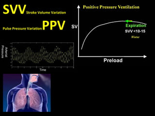 SVVStroke Volume Variation
Pulse Pressure VariationPPV
Preload
 
