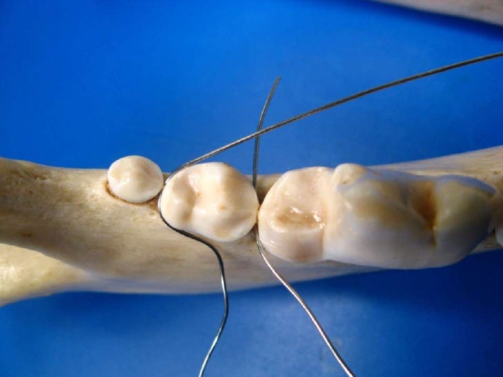 Veterinary Dentistry - Non Invasive Mandibular Fracture Repair in Dog…