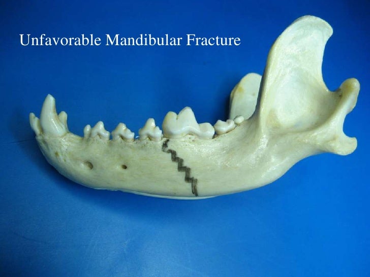 Veterinary Dentistry Non Invasive Mandibular Fracture Repair in Dog…