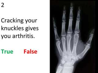 2 Cracking your knuckles gives you arthritis. True   False 