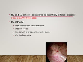 • HG and LG cancers- considered as essentially different diseases
(Hasui et al,1994; Droller, 2005).
• LG pathway-
• leads to nonvasive papillary tumors
• indolent course
• Can convert to or asso with invasive cancer
• Chr 9q abnormality
 