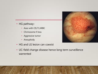 • HG pathway-
• Asso with CIS,T1,MIBC
• Chrmosome 9 loss
• Aggressive tumor
• Aneuploidy
• HG and LG lesion can coexist
• UC-field change disease hence long term surveillence
warrented
 