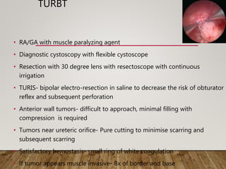 TURBT
• RA/GA with muscle paralyzing agent
• Diagnostic cystoscopy with flexible cystoscope
• Resection with 30 degree lens with resectoscope with continuous
irrigation
• TURIS- bipolar electro-resection in saline to decrease the risk of obturator
reflex and subsequent perforation
• Anterior wall tumors- difficult to approach, minimal filling with
compression is required
• Tumors near ureteric orifice- Pure cutting to minimise scarring and
subsequent scarring
• Satisfactory hemostasis- small ring of white coagulation
• If tumor appears muscle invasive- Bx of border and base
 