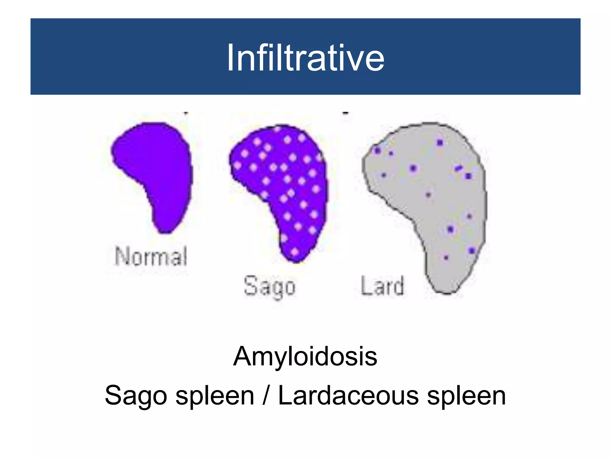 Non neoplastic lesions of lymph node | PPTX