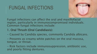FUNGAL INFECTIONS
Fungal infections can affect the oral and maxillofacial
region, particularly in immunocompromised individuals.
Common fungal infections include:
1. Oral Thrush (Oral Candidiasis):
- Caused by Candida species, commonly Candida albicans.
- Presents as creamy white patches on the oral mucosa,
tongue, or throat.
- Risk factors include immunosuppression, antibiotic use,
and poorly fitting dentures.
 