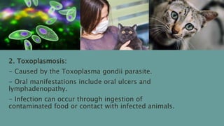 2. Toxoplasmosis:
- Caused by the Toxoplasma gondii parasite.
- Oral manifestations include oral ulcers and
lymphadenopathy.
- Infection can occur through ingestion of
contaminated food or contact with infected animals.
 