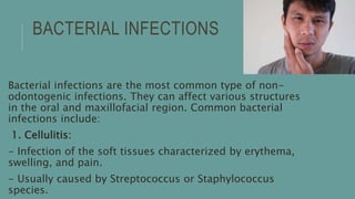 BACTERIAL INFECTIONS
Bacterial infections are the most common type of non-
odontogenic infections. They can affect various structures
in the oral and maxillofacial region. Common bacterial
infections include:
1. Cellulitis:
- Infection of the soft tissues characterized by erythema,
swelling, and pain.
- Usually caused by Streptococcus or Staphylococcus
species.
 