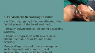 2. Cervicofacial Necrotizing Fasciitis:
- A life-threatening infection affecting the
fascial planes of the head and neck.
- Usually polymicrobial, including anaerobic
bacteria.
- Rapidly progressive with severe pain,
edema, systemic toxicity, and tissue
necrosis.
Proper diagnosis and timely management,
including antibiotics and surgical
 