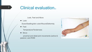 Non operative management of fractures | PPTX