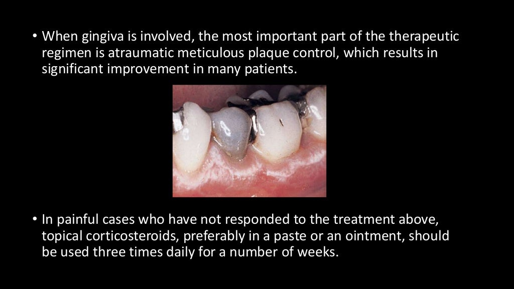 Non plaque induced gingivitis
