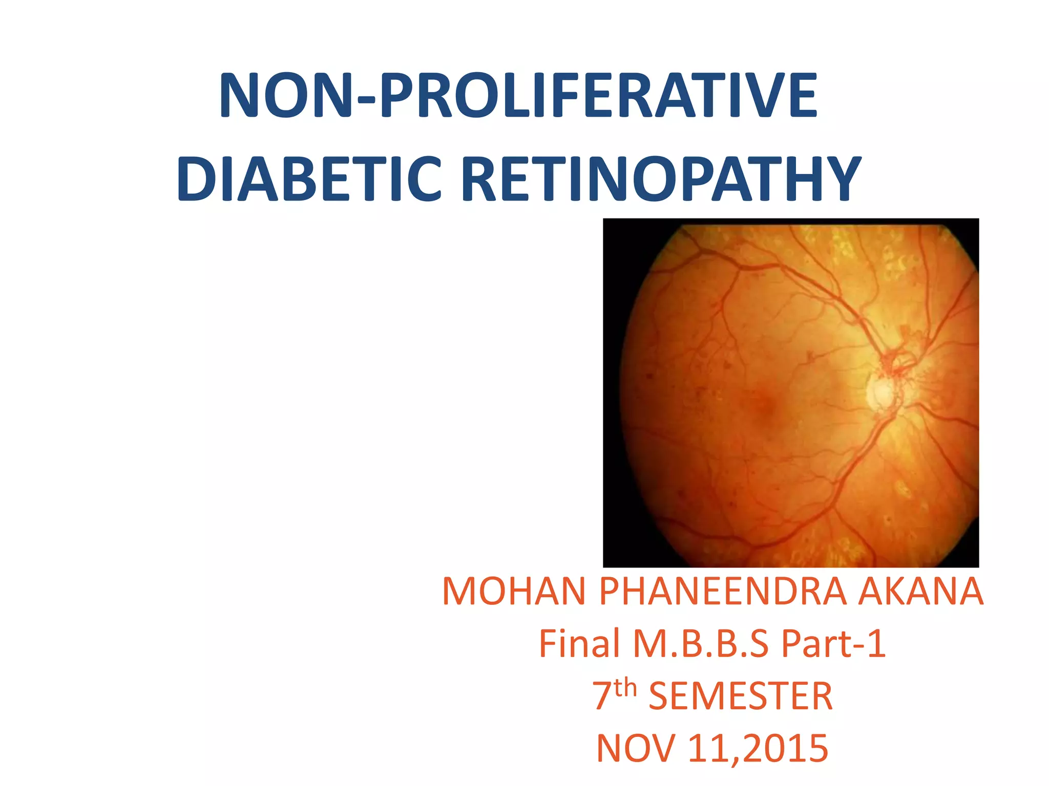 Non proliferative diabetic retinopathy by phaneendra akana | PPT