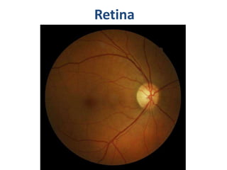 Non proliferative diabetic retinopathy by phaneendra akana | PPTX